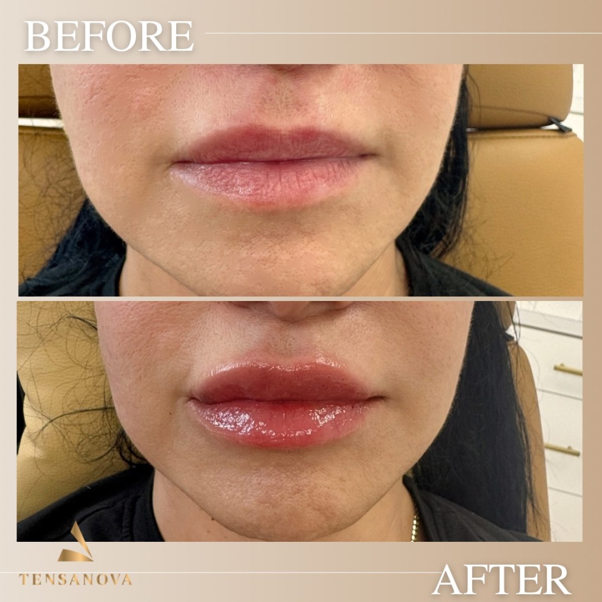 Beige Minimalist Skincare Before and After Instagram Post