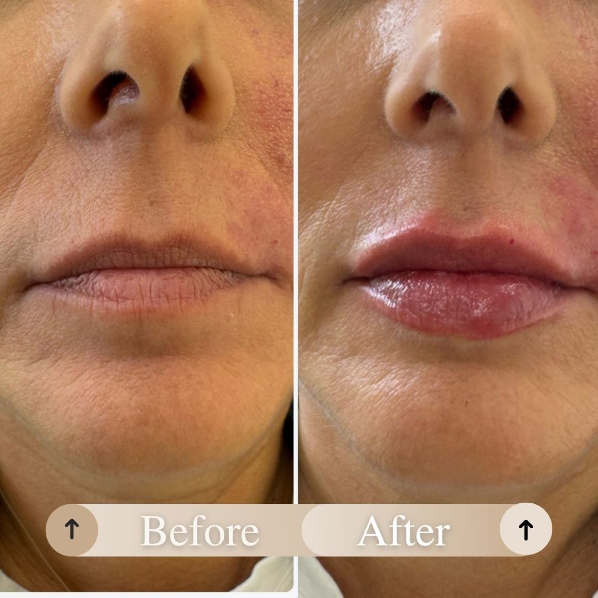 Beige Minimalist Skincare Before and After Instagram Post.zip - 2